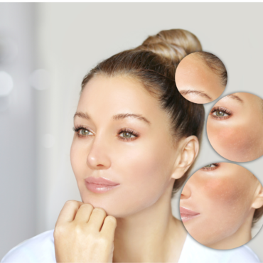 Dark Spot Body Peel | 45 Minutes