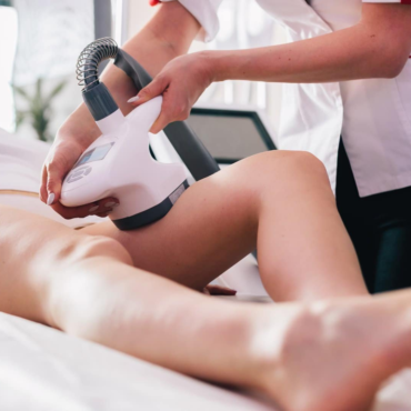 CRYOTEC Cryolipolysis Upper Outer Thighs | 30 minutes