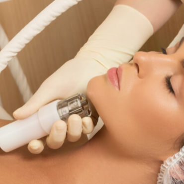 CRYOTEC Cryolipolysis Double Chin' | 30 minutes