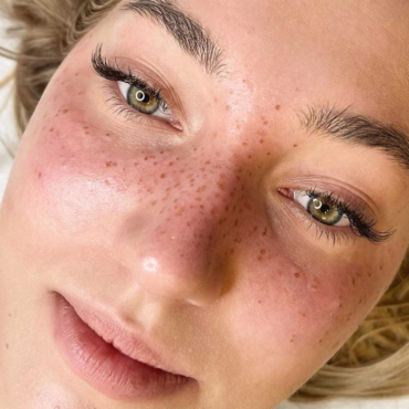 Permanent Makeup Freckles | 45 minutes
