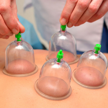 Cupping | 40 minutes