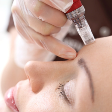 Microneedling and BB GLOW Training with kit