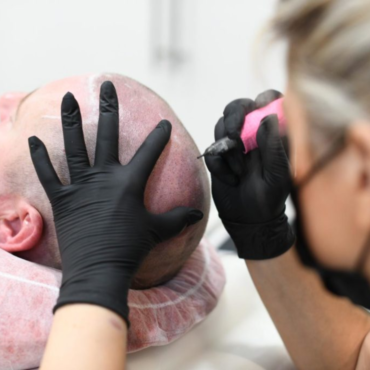 Scalp Micropigmentation | 1 hr