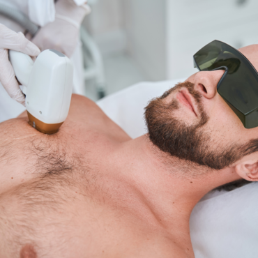 Laser Hair Removal for Men( Full Chest, Stomach, Back) | 30 Minutes
